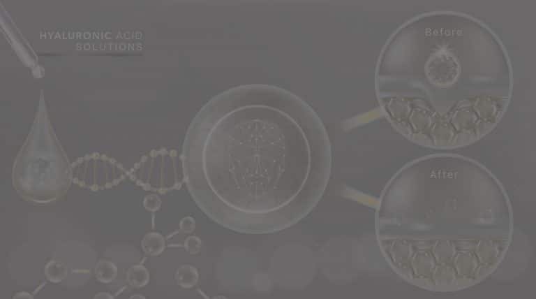 non-hyaluronic acid dermal fillers